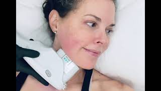MY FIRST ULTHERAPY EXPERIENCE SKIN TIGHTENING TREATMENT!