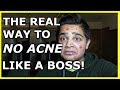 The REAL way to no acne like a BOSS!