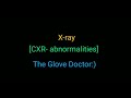 X-RAY (chest x-ray) - normal markings, abnormal airway, cardiomegaly
