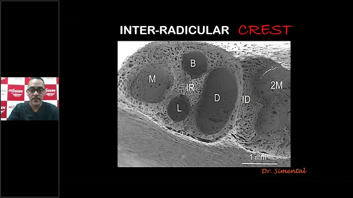 Webinar sobre Fulcrum Implant impartido por el Dr....