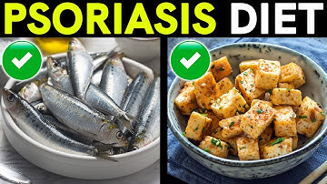 Psoriasis Treatment and Diet: Foods to Eat and Avoid