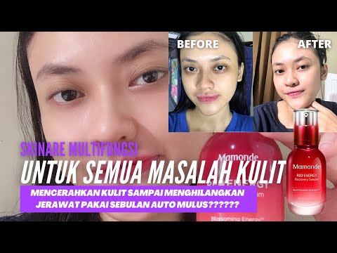 SERUM SEGALA MASALAH KULIT ANTI-AGING, MENCERAHKAN | Mamonde Red Energy Recovery Serum | Mega Ayu
