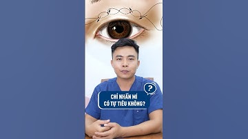 Chỉ nhấn mí có tự tiêu không? #nhanmi #kangnam #phauthuatthammy