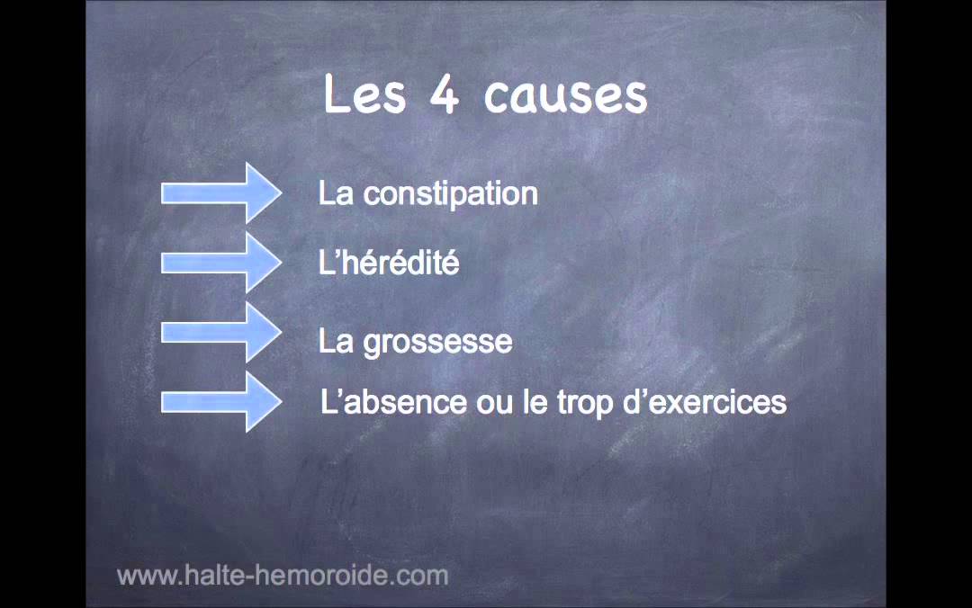 Hemoroide Interne: mode d'emploi - YouTube Hemoroide Interne: mode d'emploi - YouTube