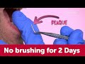 Understanding Plaque and Oral Hygiene