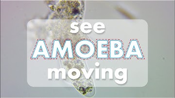 Hi, Amoeba. Where are you going? See how Amoeba moves under the microscope