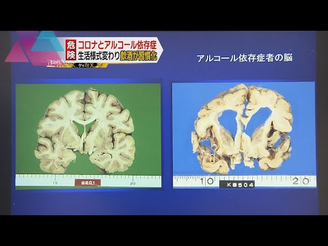 【ゲキツイX】コロナ自粛で要警戒「アルコール依存症」の危険