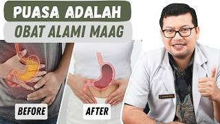 Puasa Adalah Obat Alami Asam Lambung Dan Maag Paling Ampuh  Dokter Saddam Ismail