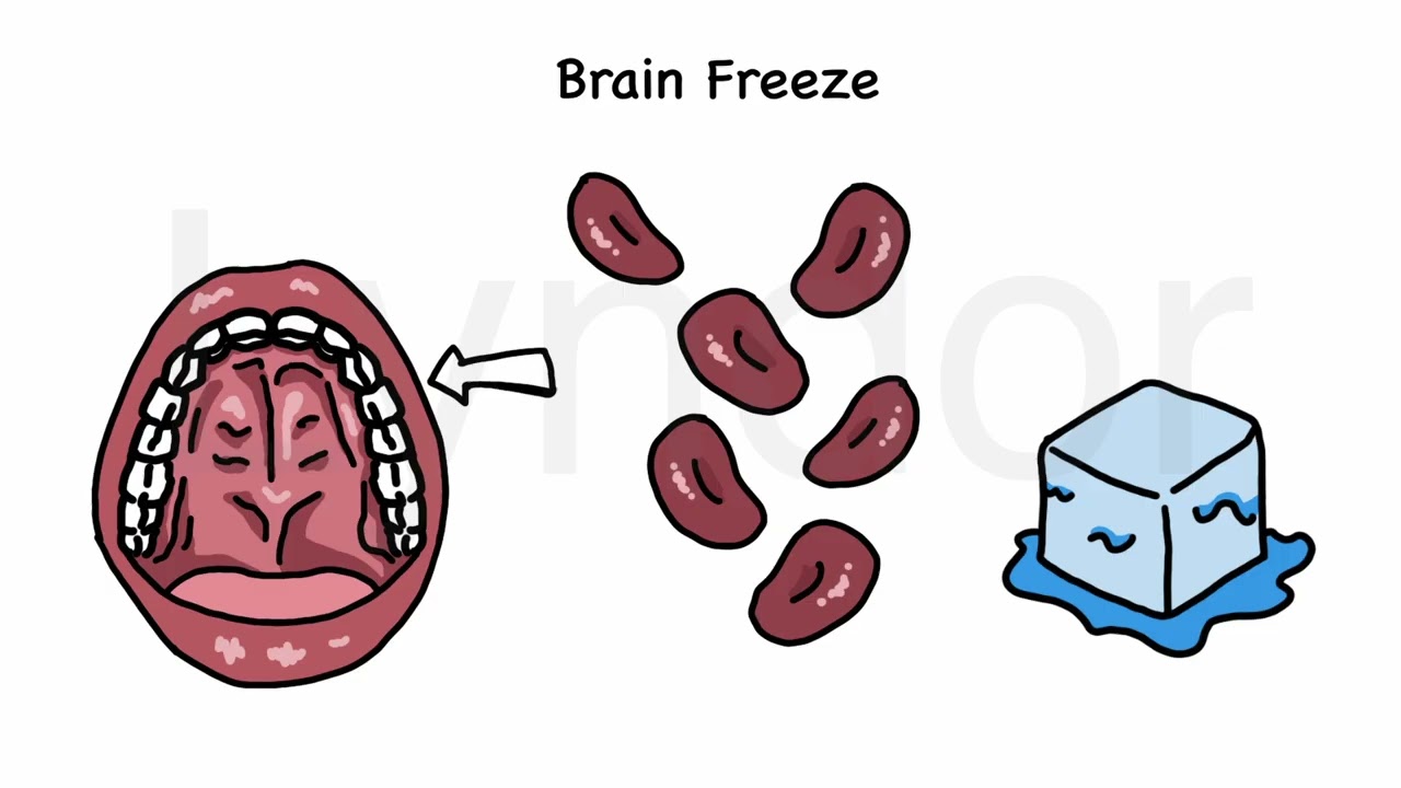 Brain freeze Sample