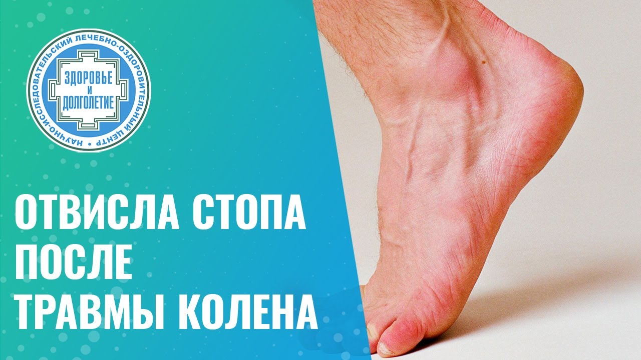 🦵 Отвисла стопа после травмы колена - YouTube