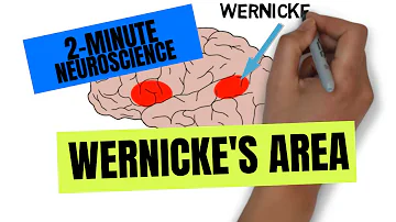 Dove si trova l'area di Wernicke?