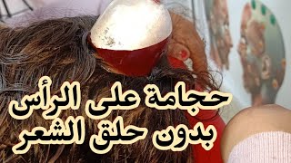 حجامة اليافوخ بدون حلق الشعر