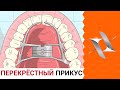 ПЕРЕКРЁСТНЫЙ прикус | Причины. Последствия. Лечение.