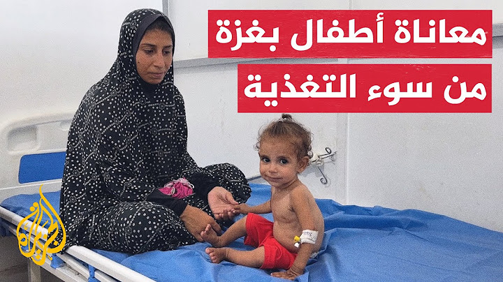 أطفال في مستشفى العودة يعانون من سوء التغذية