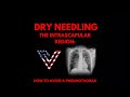Dry Needling Gone Wrong: Breaking Down the Pneumothorax Case