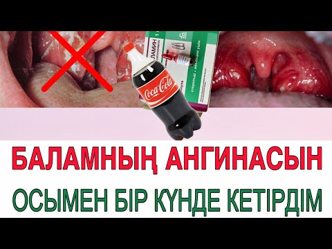 Бейне: Үйде кеудені қалай өсіру керек? Кеудені йодпен қалай үлкейтуге болады?