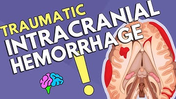 Intracranial Hemorrhage