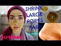 How To Get Rid of Large Pores | Get Tighter & Smooth Skin Naturally | Shrink Pores FAST! ~ Immy
