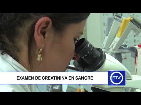 Vídeo: Examen De Creatinina En Sangre: Propósito, Preparación Y Procedimiento