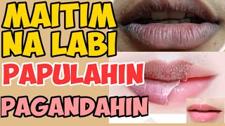 Maitim ang Labi : Paano Papulahin at Pagandahin - Payo ni Doc Liza Ramoso-Ong