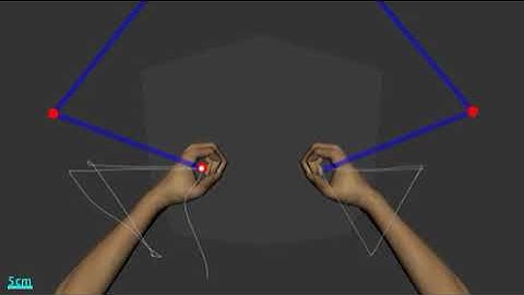 KST: Arm Movement Matching, Unhealthy Subject