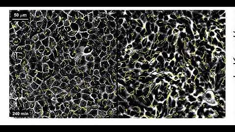 Collective cell migration