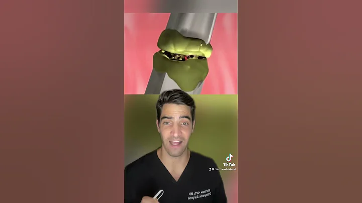 Learn how fracture and broken bones heal, this is a closer look at how your body heals