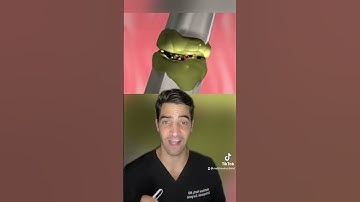 Learn how fracture and broken bones heal, this is a closer look at how your body heals