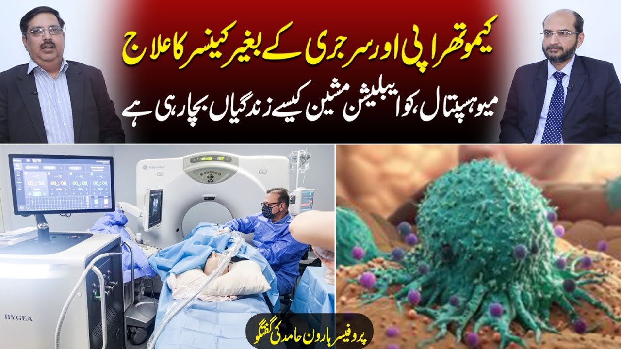 Cancer Treatment Without Chemotherapy or Surgery | Co-Ablation Tech at Mayo Hospital Is Saving Lives