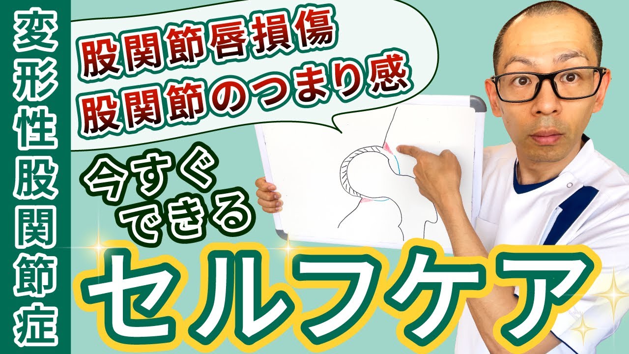第322回【股関節痛】初公開！股関節唇損傷、変形性股関節症に対するセルフケアの方法