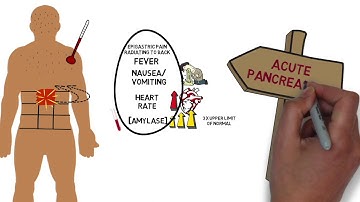 Gallstones and Laparoscopic Cholecystectomy