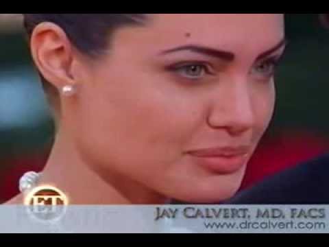 dr jay calvert review call dr calvert at 310 777 8800 jay calvert md