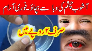 Ashob e Chashm ka Illaj Kia | Eyes Infection in Karachi | Increase in conjunctivitis cases