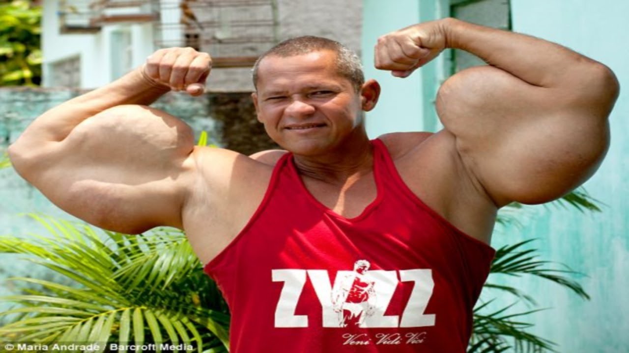 biceps tendonitis Man with 29inch big biceps