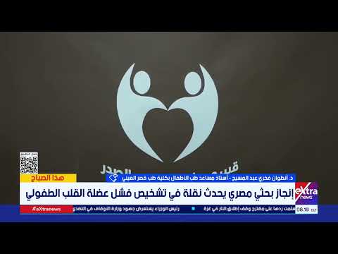 تقنية جديدة للتنبؤ بشدة أعراض القلب للأطفال .. د.أنطوان فخري عبد المسيح يكشف تفاصيل الإنجاز الكبير