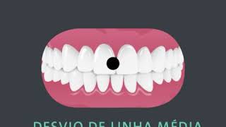 Alinhadores ClearCorrect