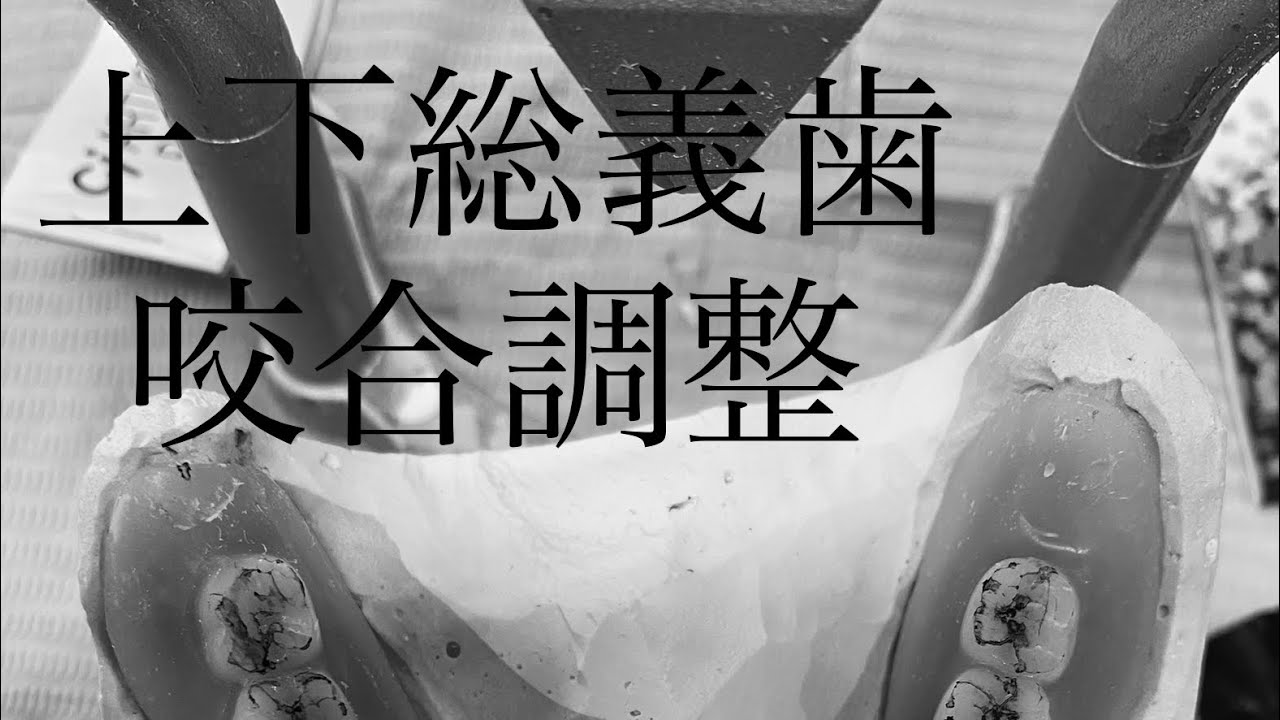 咬合器上での咬合調整 - YouTube