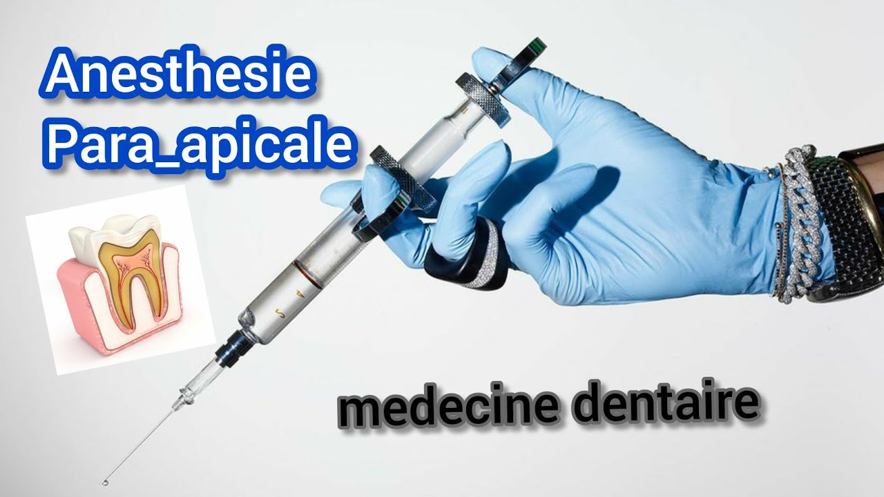 anesthesie para-apicale dentaire💉 🦷||protocole,avantages,inconvénients...