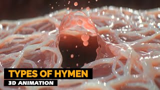 Types of Hymen | 3D Animation