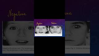 Bruckners Test Squint