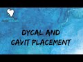 Dycal  cavit  mixapply temporary filling cavit  dental assistant