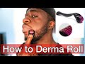 HOW TO DERMA ROLL FOR BEARD GROWTH- 2020 METHOD |MINOXIDIL BEARD JOURNEY