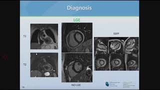 David Lin, MD - Diagnosis and Management of Pericarditis