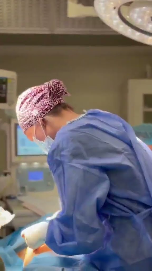 Rezultate: înainte și după — Implant mamar