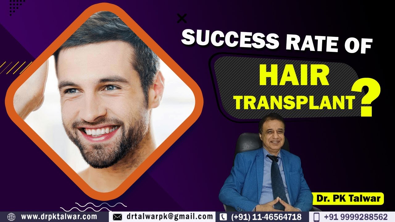 What Is The Success Rate Of Hair Transplant in India, Hair Transplant