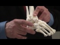 Treatment of clubfoot demonstration large model