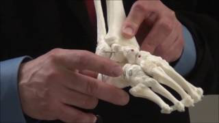 Treatment of Clubfoot Demonstration- Large Model