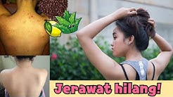 LULUR KOPI PALING AMPUH UNTUK MENGHILANGKAN JERAWAT PUNGGUNG DAN WAJAH - Durasi: 4.03. LULUR KOPI PALING AMPUH UNTUK MENGHILANGKAN JERAWAT PUNGGUNG DAN WAJAH - Durasi: 4.03.
