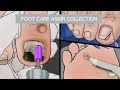 ASMR Foot Care Animation Collection / bruised toenail / Ingrown Toenail /corn removal
