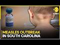 Measles Outbreak In South Carolina: Children Aged 4 And Under At Risk | WION